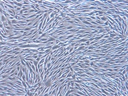 Five Tips for Scaling Up Human Mesenchymal Stem Cells