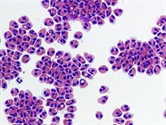 A Guide to Eosinophil Markers