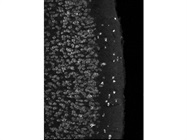Reliable Reelin Positive Cells Labelling