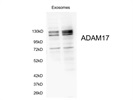 ADAM17 for WB Gives Great Results