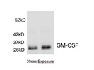 Great GM-CSF Antibody from BioLegend