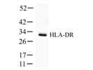 Reliable Anti-HLA-DR Antibody for Western Blot