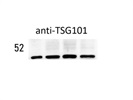 Great Antibody for TSG101-Detection