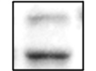 Reliable Detection of Phosphorylated MK2