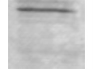 Reliable Antibody for Detecting BCL2