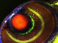 Label-free Chemical Microscopy with Coherent Raman Scattering