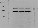 Good Antibody to Detect CPT1B in Mouse Tissue