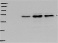 Excellent MyBioSource Antibody for Immunodetection of DGAT1 in Human