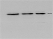 State of the Art Antibody for the Immunodetection of DGAT1 in Human
