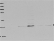 Excellent Antibody for Immunodetection of DGAT2 in Human