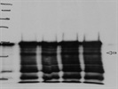 Bad Immunodetection of DGAT2 Protein Levels in Mouse Cell