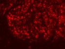 Anti-BCL2 Antibody for Immunfluorescence