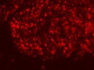 Anti-BCL2 Antibody for Immunfluorescence