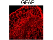 Great GFAP Detection