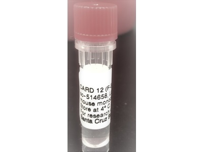 Consistent Western Blot CARD12 Antibody | Biocompare Antibody Review