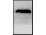 Consistent and Easy to Optimize Beclin Antibody