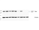 Pefect TACE Antibody for WB
