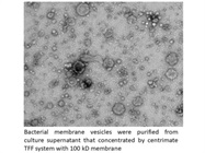 LV Centramate TFF System Works Great for Purification of EVs