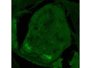 Anti-Choline Acetyltransferase Antibody for Immunofluorescence
