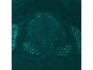 Anti-Isl1 Antibody for Immunofluorescence