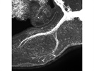 Dependable Anti-Neurofilament-M Antibody for Immunofluorescence