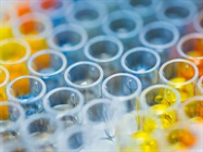 xMAP® INSIGHTS: Assay Development Issue