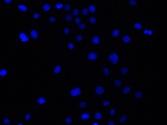 Issues with Detecting SRp40 in Keratinocytes