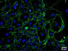 ß-2-Microglobulin Antibody Works Fine in Human Samples