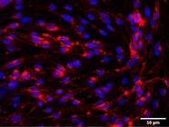 Straightforward Marker for Endothelial Cells