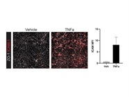 ICAM-1 Staining of Primary Endothelial Cells
