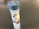 Good SMAD2 Antibody for Western Blot