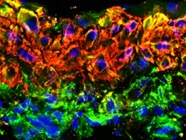 Very Good Caldesmon Antibody
