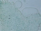 Kit Detects Senescence-Associated Beta-Galactosidase in Fresh Gonadal and Subcutenous Fat of Chronologically Aged Mice