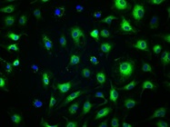 Fluorescent Method to Detect Senescence-Associated Beta Galactosidase