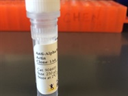 Good a-SMA Antibody for Immunostaining Experiment