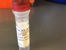 Perfect P-SMAD3 Antibody for Immunostaining