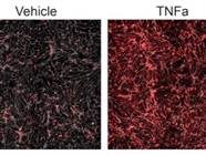 VCAM-1 Staining for Fluorescence Imaging