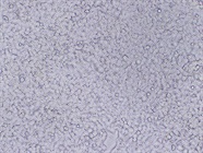 Choosing between Stable and Transient Transfection