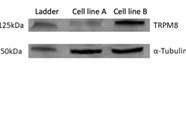 Good Antibody for TRPM8 Western Blot