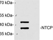 Great Anti-NTCP Antibody