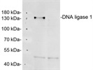 Excellent Anti-DNA Ligase 1 Antibody