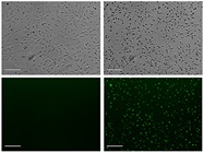 Critical Factors to Consider for Automated Live-Cell Imaging