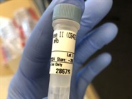 Great HKII Antibody For Western Blot