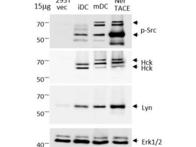 Great Antibody to Detect ERK through WB | Biocompare
