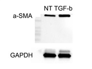 Good a-Smooth Muscle Antibody for Western Blot