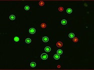 Improving the Accuracy of Automated Cell Counting