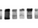 Good Fibronectin Antibody for Western Blot