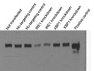 Excellent Antibody for the Detection of IRE1