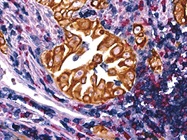 Immunohistochemistry Troubleshooting
