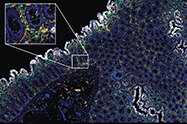 Precise Spatial Multiplexing Technology for Multi-Omics Research